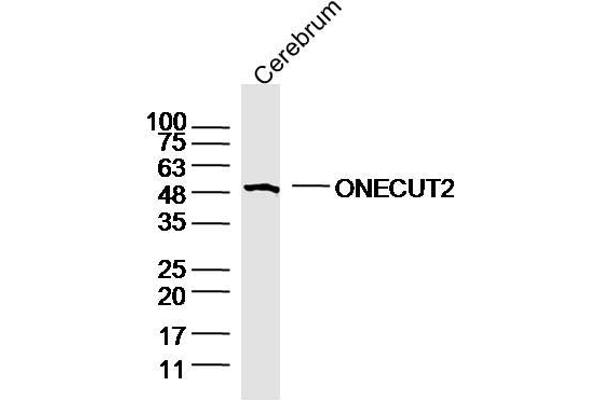 ONECUT2 抗体  (AA 401-504)