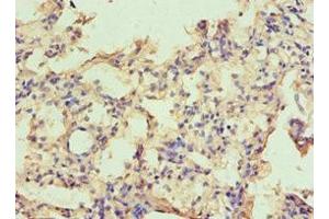 Immunohistochemistry of paraffin-embedded human lung tissue using ABIN7146531 at dilution of 1:100 (CAPNL1 anticorps  (Catalytic Subunit))