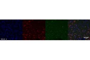 Immunohistochemistry (IHC) image for anti-Nuclear Receptor Subfamily 3, Group C, Member 2 (NR3C2) antibody (ABIN7456028)