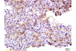 Formalin-fixed and paraffin embedded rat melanoma labeled with Anti-SPANX Polyclonal Antibody, Unconjugated (ABIN721675) at 1:200 followed by conjugation to the secondary antibody and DAB staining. (SPANXC anticorps  (AA 21-97))