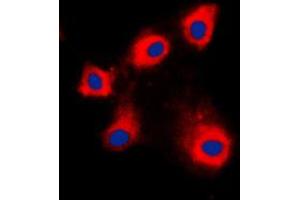 Immunofluorescent analysis of HSPE1 staining in NIH3T3 cells. (HSPE1 anticorps  (Center))