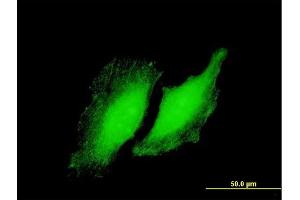 Immunofluorescence of purified MaxPab antibody to RYBP on HeLa cell.