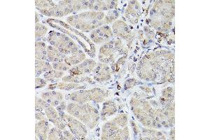Immunohistochemistry of paraffin-embedded Human normal pancreas using Bcl-2 antibody (ABIN7265810) at dilution of 1:100 (40x lens).