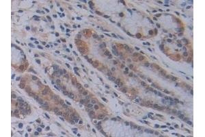 Detection of PEBP1 in Human Stomach Tissue using Polyclonal Antibody to Phosphatidylethanolamine Binding Protein 1 (PEBP1) (PEBP1 anticorps  (AA 2-187))