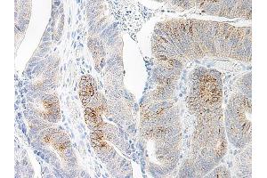 Image no. 2 for anti-Chemokine (C-C Motif) Ligand 20 (CCL20) antibody (ABIN465457) (CCL20 anticorps)