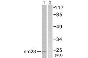 Western blot analysis of extracts from K562 cells, using NM23 Antibody. (NME1 anticorps  (AA 91-140))