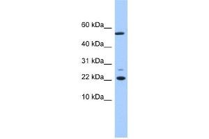 WB Suggested Anti-DPH4 Antibody Titration: 0. (DNAJC24 anticorps  (N-Term))
