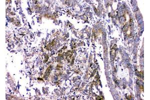 IHC analysis of RMI2 using anti-RMI2 antibody (ABIN6719656). (RMI2 anticorps)
