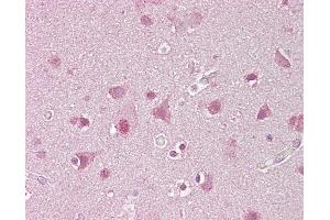 Anti-SREBF1 / SREBP-1 antibody IHC of human brain, cortex.