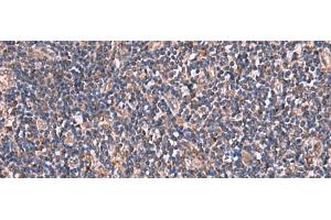 Immunohistochemistry of paraffin-embedded Human tonsil tissue using TTC38 Polyclonal Antibody at dilution of 1:85(x200)