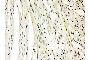 IHC testing of FFPE rat heart with SLUG antibody.