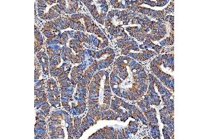 IHC analysis of SERAC1 using anti-SERAC1 antibody (ABIN7602709). (SERAC1 anticorps  (AA 97-623))