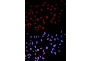 Immunofluorescence analysis of U2OS cells using Phospho-MAPK14-T180 antibody (ABIN5969910). (MAPK14 anticorps  (pThr180))