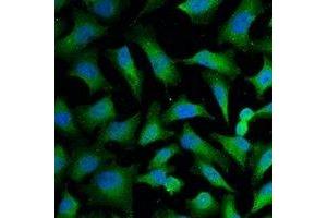 Immunofluorescent analysis of Cytokeratin 18 staining in Hela cells.