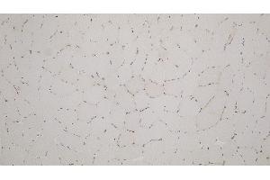 Human skeletal muscle: immunohistochemical staining for Utrophin.