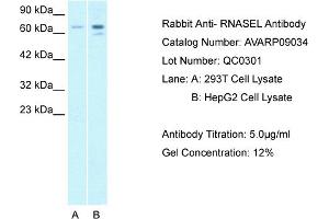 Host: Rabbit Target Name: RNASEL Sample Tissue: Human 293T Whole Cell Antibody Dilution: 1ug/ml (RNASEL anticorps  (C-Term))