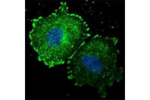 Fluorescent confocal image of MCF7 cells stained with phospho-ERBB2 antibody at 1:100.