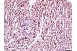 Formalin-fixed and paraffin embedded mouse stomach labeled with Anti-N acetylglucosamine kinase Polyclonal Antibody, Unconjugated (ABIN872749) at 1:200 followed by conjugation to the secondary antibody and DAB staining