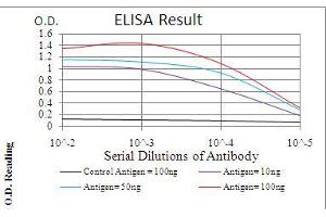 Black line: Control Antigen (100 ng), Purple line: Antigen(10 ng), Blue line: Antigen (50 ng), Red line: Antigen (100 ng), (IRAK3 anticorps  (AA 454-596))