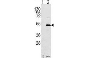 Western Blotting (WB) image for anti-Y Box Binding Protein 1 (YBX1) antibody (ABIN3002604) (YBX1 anticorps)