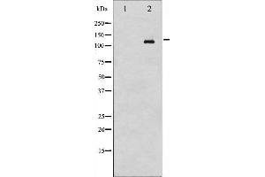 Western blot analysis of Abl phosphorylation expression in RAW264.