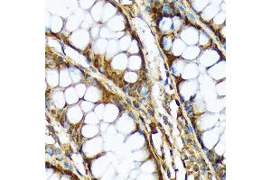 Immunohistochemistry of paraffin-embedded human colon using  Rabbit mAb (ABIN7265740) at dilution of 1:100 (40x lens). (ABCF1 anticorps)