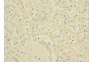Immunohistochemistry of paraffin-embedded human liver tissue using ABIN7170166 at dilution of 1:100