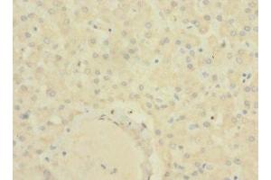 Immunohistochemistry of paraffin-embedded human liver tissue using ABIN7170166 at dilution of 1:100 (SLC22A9 anticorps  (AA 45-143))