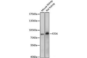 Western blot analysis of extracts of various cell line using FZD6 Polyclonal Antibody at dilution of 1:1000. (FZD6 anticorps)