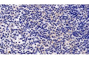 Detection of JAK2 in Porcine Lymph node Tissue using Polyclonal Antibody to Janus Kinase 2 (JAK2)