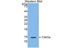 Western Blotting (WB) image for anti-S100 Calcium Binding Protein A10 (S100A10) (AA 1-95) antibody (ABIN1078495) (S100A10 anticorps  (AA 1-95))