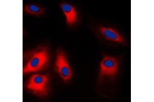 Immunofluorescent analysis of GRP78 staining in HeLa cells. (GRP78 anticorps  (C-Term))