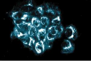 Immunofluorescence staining of A431 cells (Human epithelial carcinoma, ATCC CRL-1555). (AKAP1 anticorps  (AA 66-212))