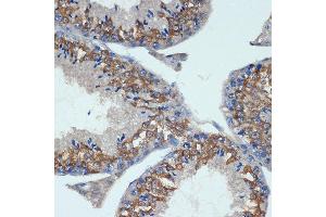 Immunohistochemistry of paraffin-embedded mouse testis using CHMP2B Rabbit mAb (ABIN7266290) at dilution of 1:100 (40x lens). (CHMP2B anticorps)