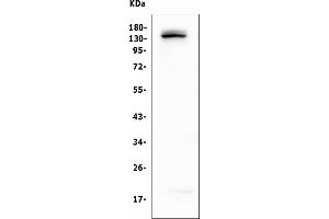 Western blot analysis of LATS1 using anti-LATS1 antibody (ABIN6719580).