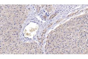 Detection of PRDX3 in Human Liver Tissue using Polyclonal Antibody to Peroxiredoxin 3 (PRDX3) (Peroxiredoxin 3 anticorps  (AA 5-233))