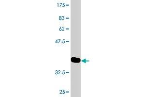 Western Blot detection against Immunogen (36. (LBX2 anticorps  (AA 95-194))