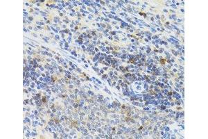 Immunohistochemistry of paraffin-embedded Rat spleen using STAT4 Polyclonal Antibody at dilution of 1:100 (40x lens). (STAT4 anticorps)