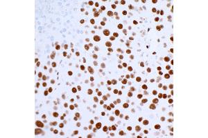 Immunohistochemistry (IHC) image for anti-Tumor Protein P53 Binding Protein 1 (TP53BP1) (AA 350-400) antibody (ABIN7455070)
