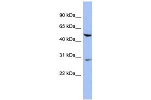 Cytokeratin 75 antibody used at 1 ug/ml to detect target protein. (Keratin 75 anticorps  (N-Term))