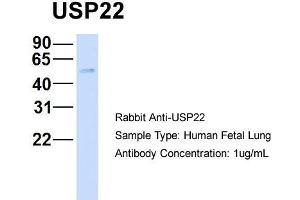 Host: Rabbit   Target Name: USP22   Sample Tissue: Human Fetal Lung  Antibody Dilution: 1. (USP22 anticorps  (Middle Region))