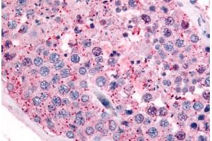 Human Testis (formalin-fixed, paraffin-embedded) stained with PAK6 antibody ABIN213527 at 10 ug/ml followed by biotinylated goat anti-rabbit IgG secondary antibody ABIN481713, alkaline phosphatase-streptavidin and chromogen.