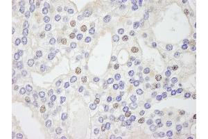 anti-GTF2IRD/TFII-IRD1 (AA 650-700) antibody