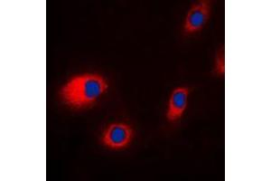 Immunofluorescent analysis of CLCN7 staining in HeLa cells.