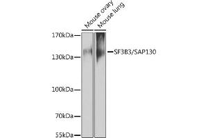 Western blot analysis of extracts of various cell lines, using SF3B3/S antibody (ABIN6128696, ABIN6147668, ABIN6147669 and ABIN6221751) at 1:1000 dilution.