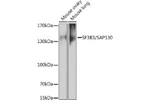 Western blot analysis of extracts of various cell lines, using SF3B3/S antibody (ABIN6128696, ABIN6147668, ABIN6147669 and ABIN6221751) at 1:1000 dilution. (SF3B3 anticorps  (AA 948-1217))
