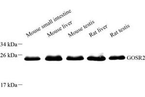 Western blot analysis of Membrin (ABIN7074118) at dilution of 1: 8000