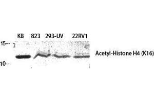 Western Blot (WB) analysis of specific cells using Acetyl-Histone H4 (K16) Polyclonal Antibody. (Histone H4 anticorps  (acLys16))