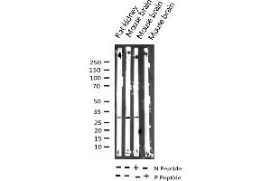 Western blot analysis of Phospho-DARPP-32 (Thr34) expression in various lysates (DARPP32 anticorps  (pThr34))