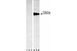 Lysate from control (First Panel) and pervanadate-treated (Second Panel) Ramos cells (Burkitt's lymphoma) were probed with mAb I120-722 at concentrations of 0. (SYK anticorps  (pTyr348))